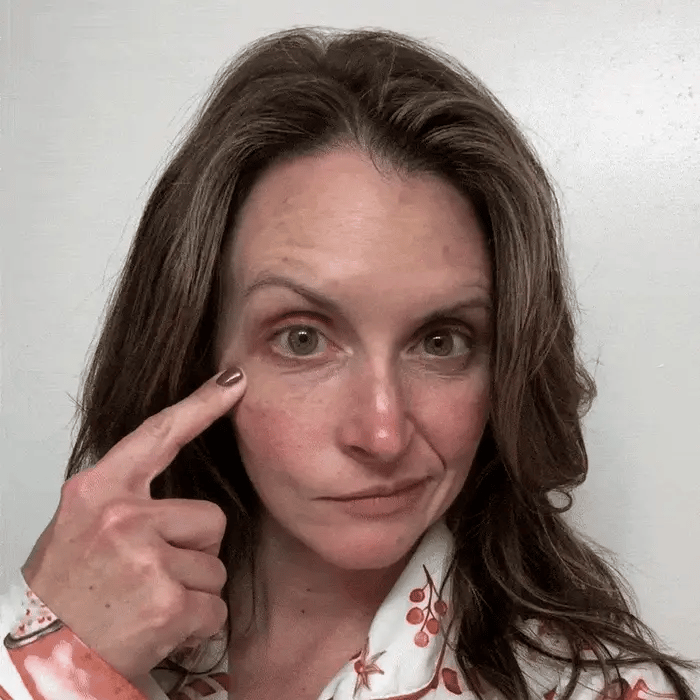 Serum Infused Microneedle Under Eye Patches
